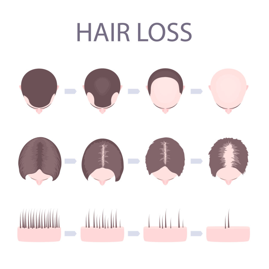 Hair loss prevention graphic - best hair care products -